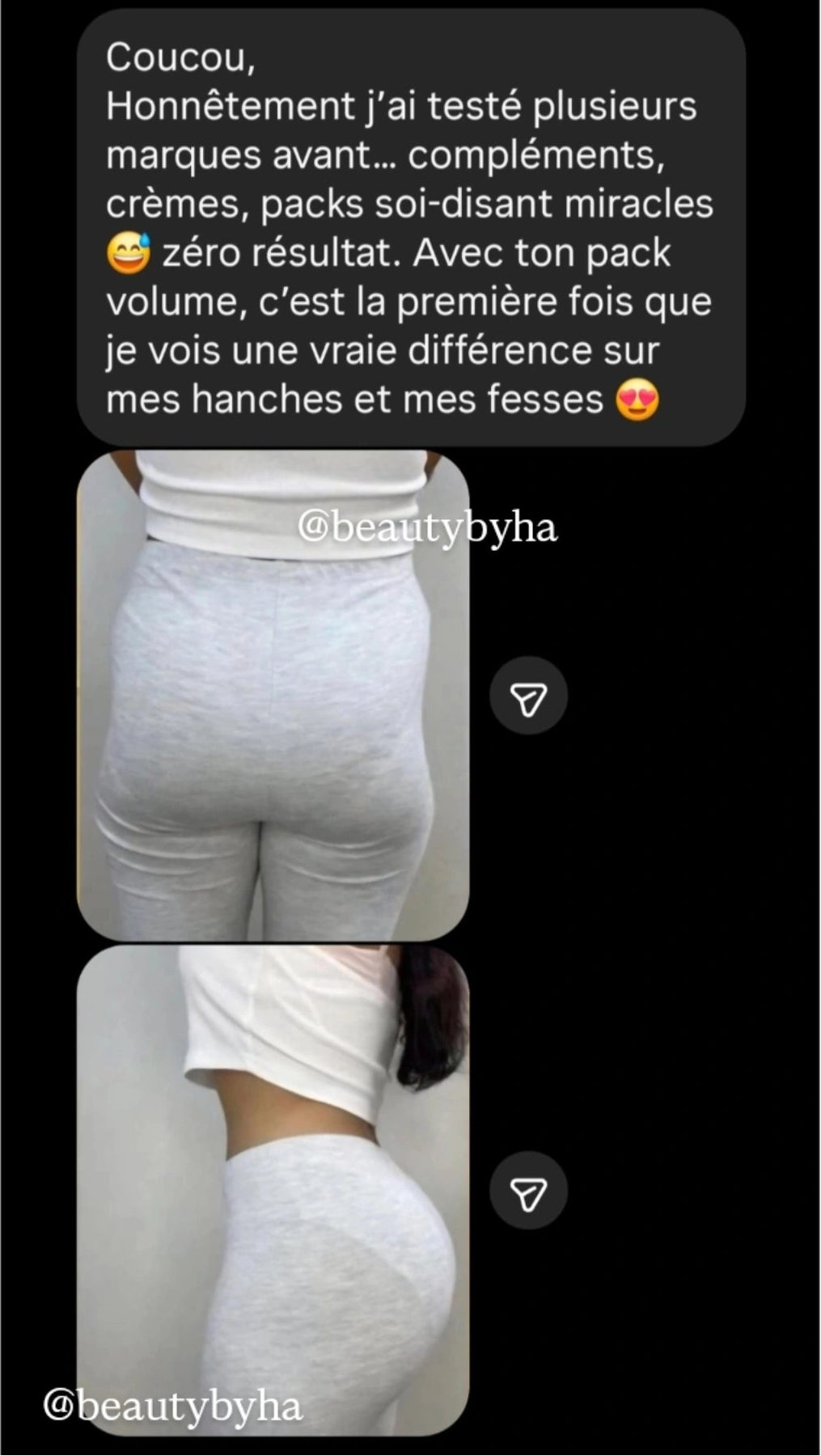 avant/après hanche fesse pack volume résultat cliente